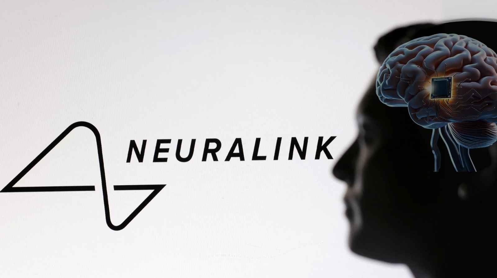 Neuralink’s Brain Implants Breakthrough